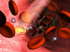 Light-activated antibody attaches to a tumour site. Reproduced by courtesy of Biotransformations Ltd